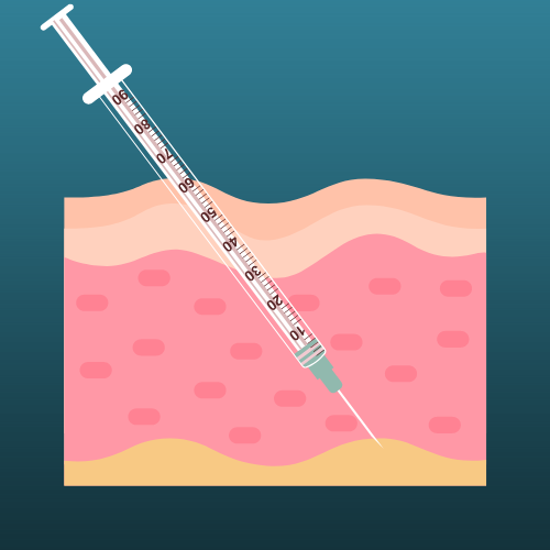 Subcutaneous injection technique